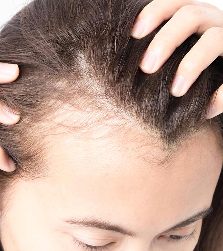 Hair Growth Bald Patches in tamil