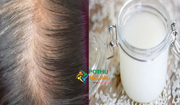 How To Grow Hair on Bald Head Naturally in Tamil