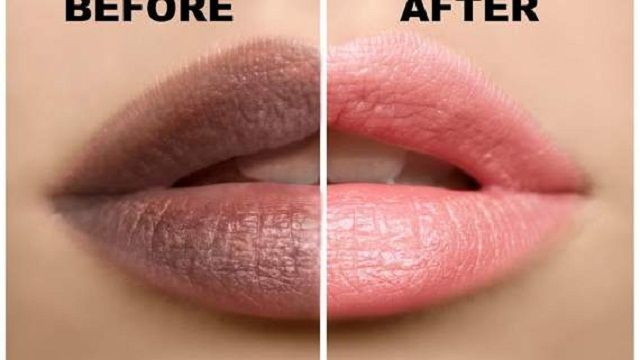 How to make Your Lips Pink Naturally Permanently in Tamil