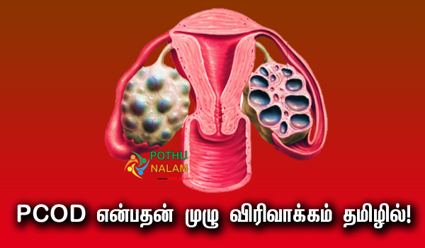 PCOD full Form in Tamil