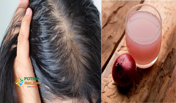 Regrow Hair Naturally in 3 Weeks at Home in tamil