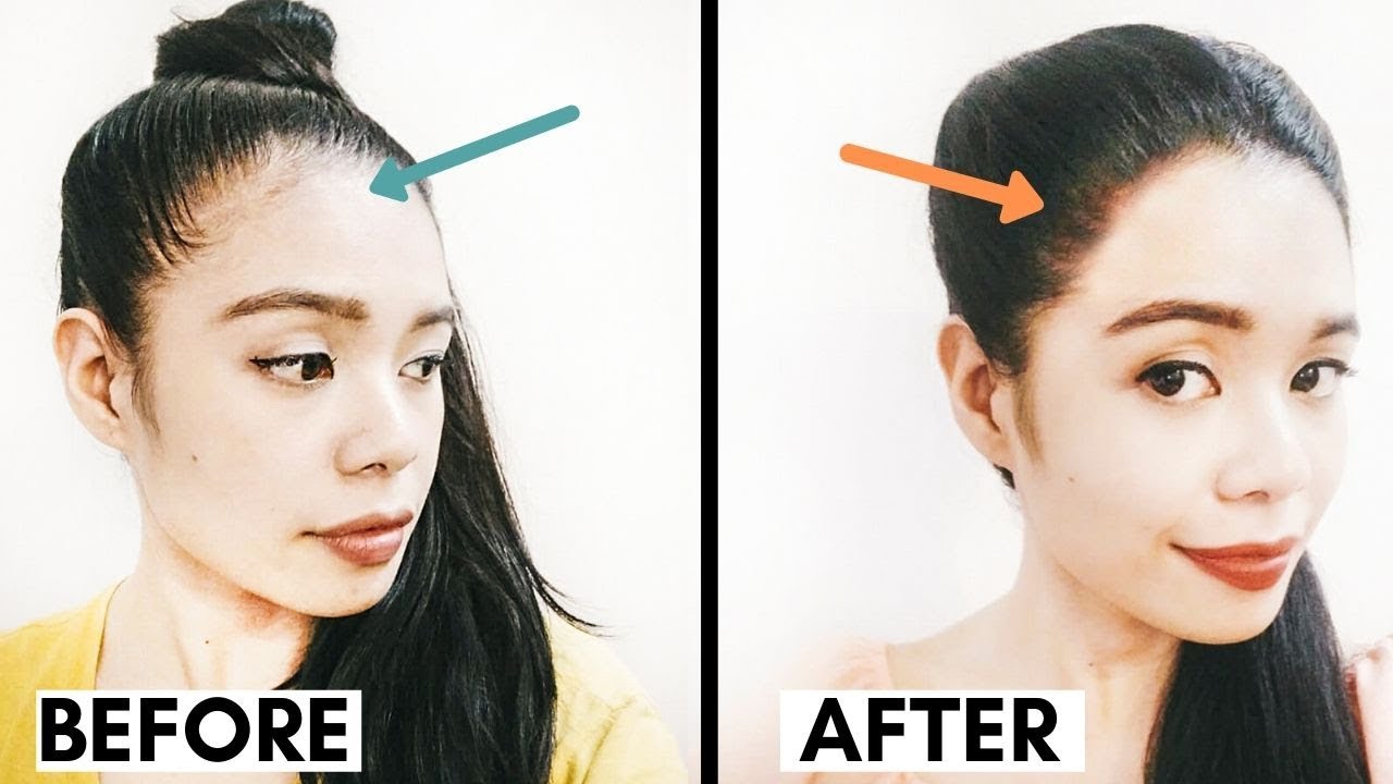  how to grow hair on forehead naturally faster in tamil