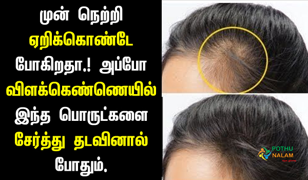 how to grow hair on forehead naturally faster in tamil
