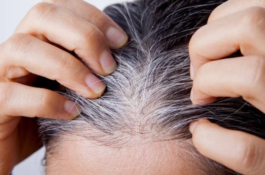 Permanent White Hair Removal at Home in Tamil