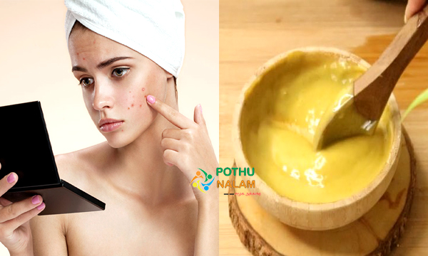 Face Dark Spot Removal Home Remedies in Tamil