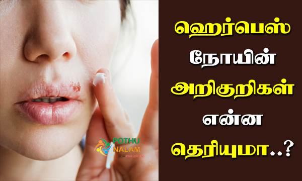 Herpes Symptoms in Tamil
