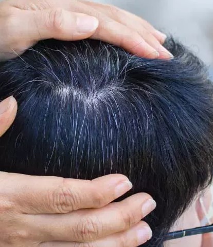 Home Remedies for Grey Hair in Tamil