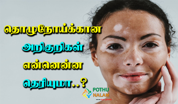 Leprosy Symptoms in Tamil