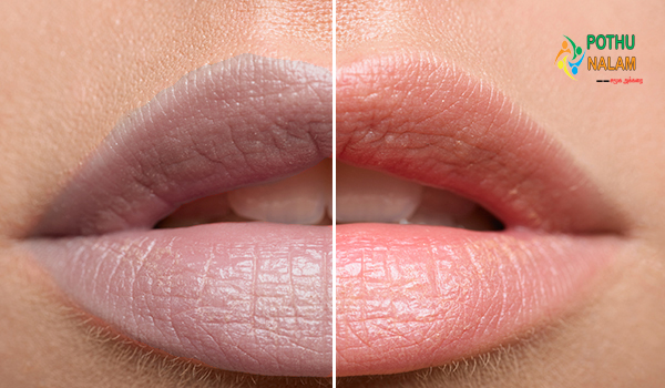 Natural Tips for Rosy Lips in Tamil