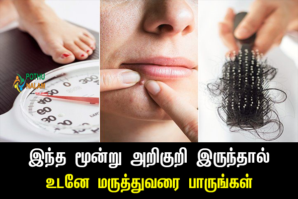 Pcos Meaning in Tamil Symptoms