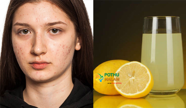 how to remove scars from face quickly in tamil