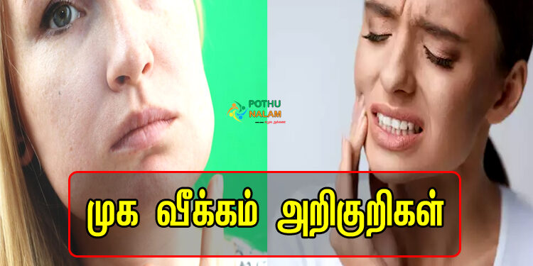 Symptoms of Facial Swelling in Tamil
