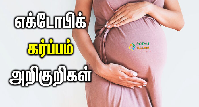 ectopic pregnancy symptoms in tamil