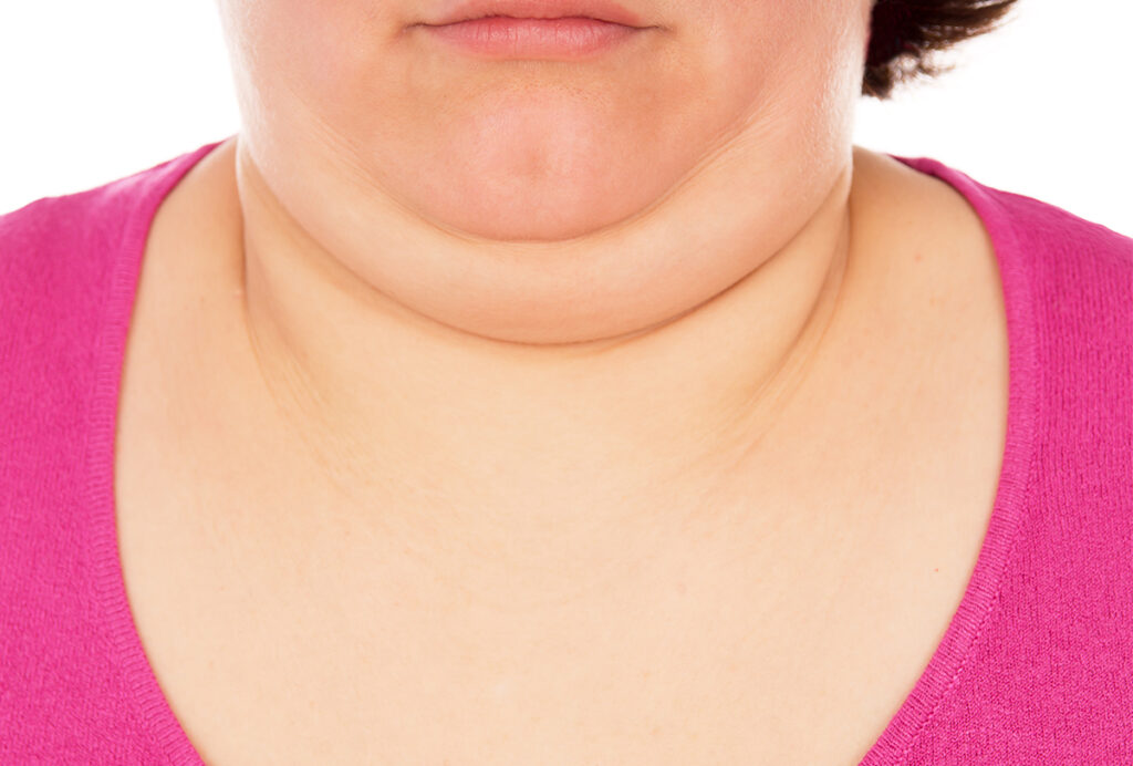 Home Remedies For Double Chin Fast in Tamil
